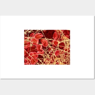 Blood clot, SEM (P260/0107) Posters and Art